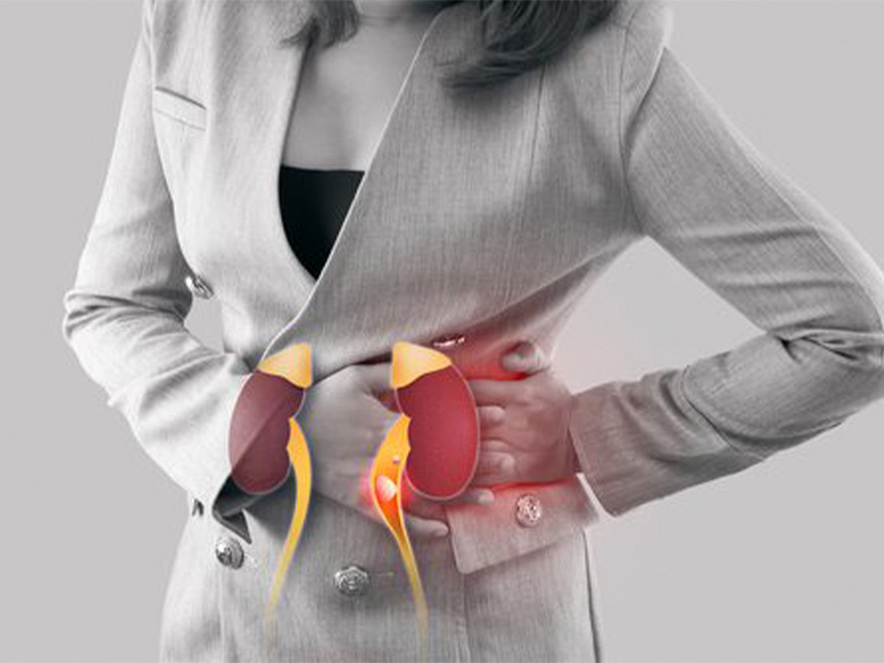 sỏi niệu quản là gì?