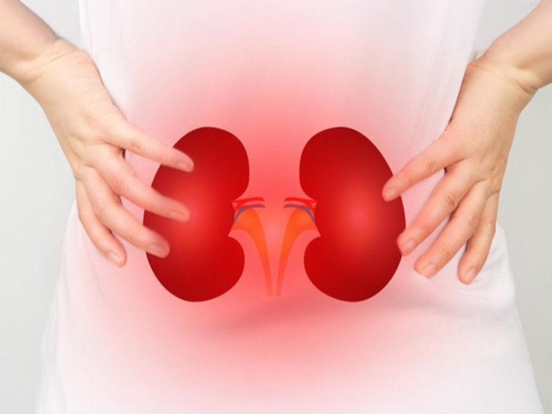 Cặn thận là giai đoạn đầu của sỏi thận