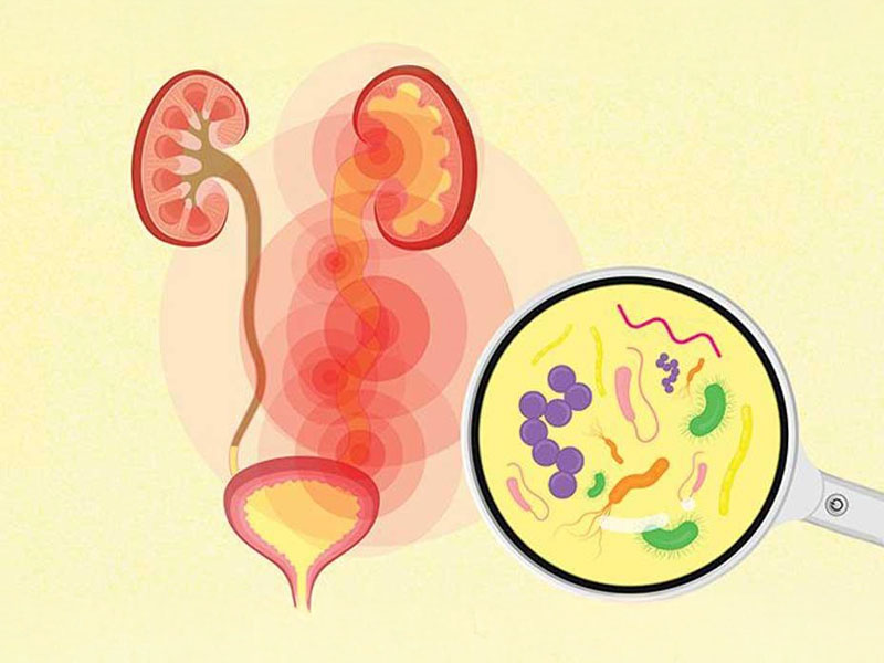 Nhiễm trùng tiểu thường tập trung ở phần dưới ở hệ tiết niệu 