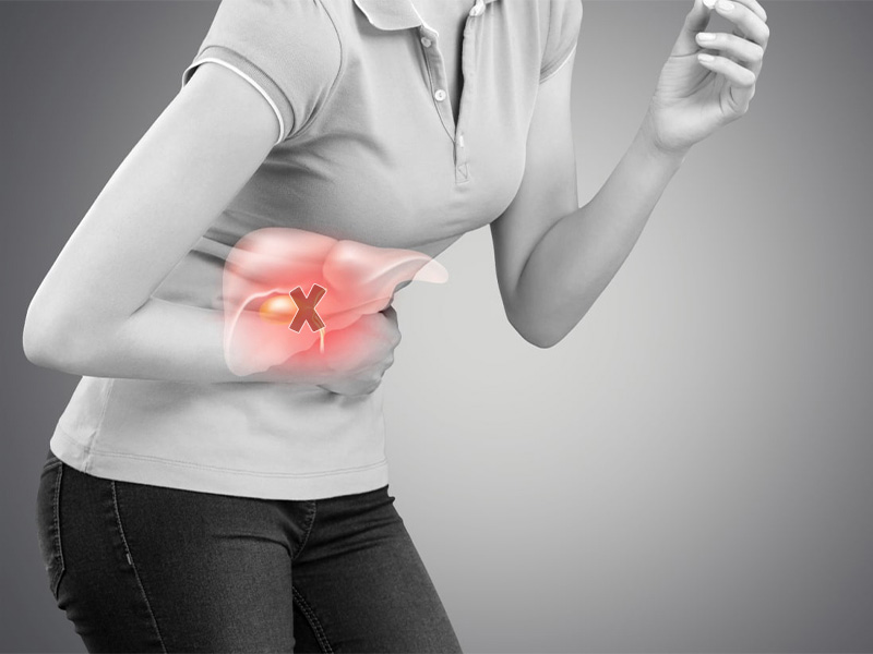 Tại sao sau khi cắt túi mật vẫn bị đau?