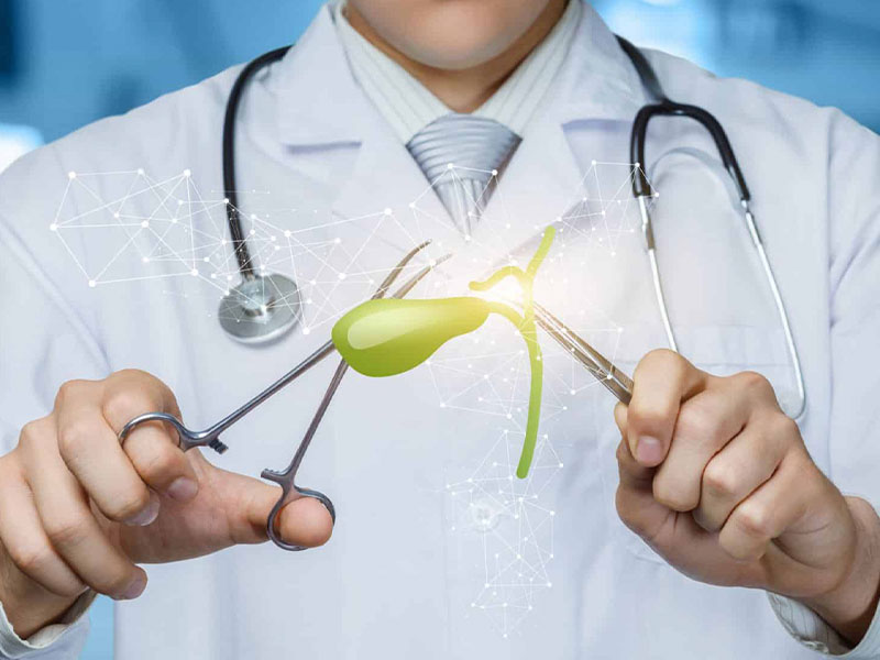 Các trường hợp cần can thiệp mổ sỏi mật