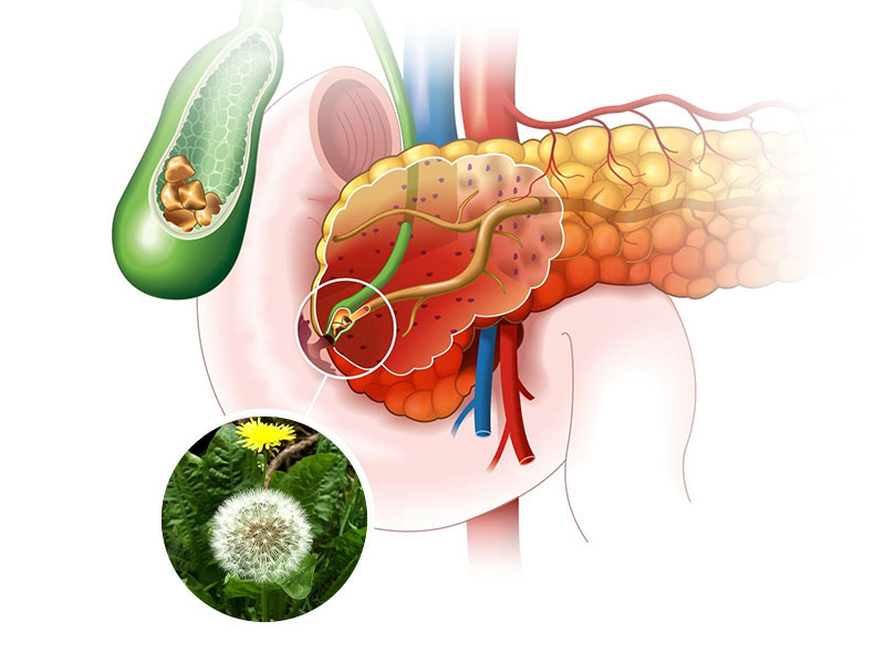 Cách đào thải sỏi mật bằng hoa bồ công anh 